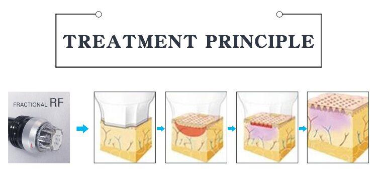 Microneedle Rf Radio Frequency Machine Microneedle Rf And Fractional Rf Sanhe Beauty Machine For Face Lift